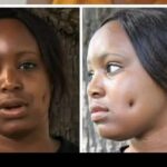 Regret Over Fake Dimples: Nigerian Lady's N3,000,000 Mistake